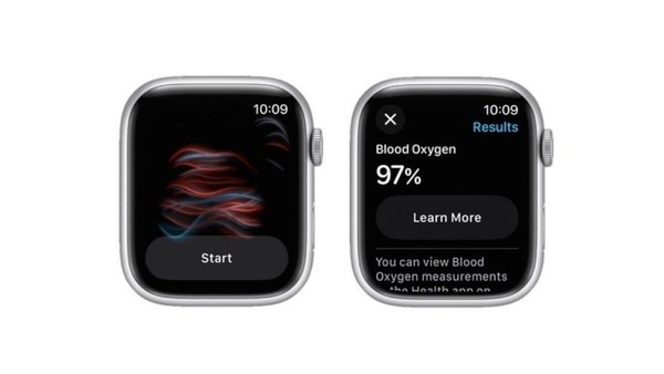 Apple Watch saved an airline passenger’s life because of its blood oxygen function